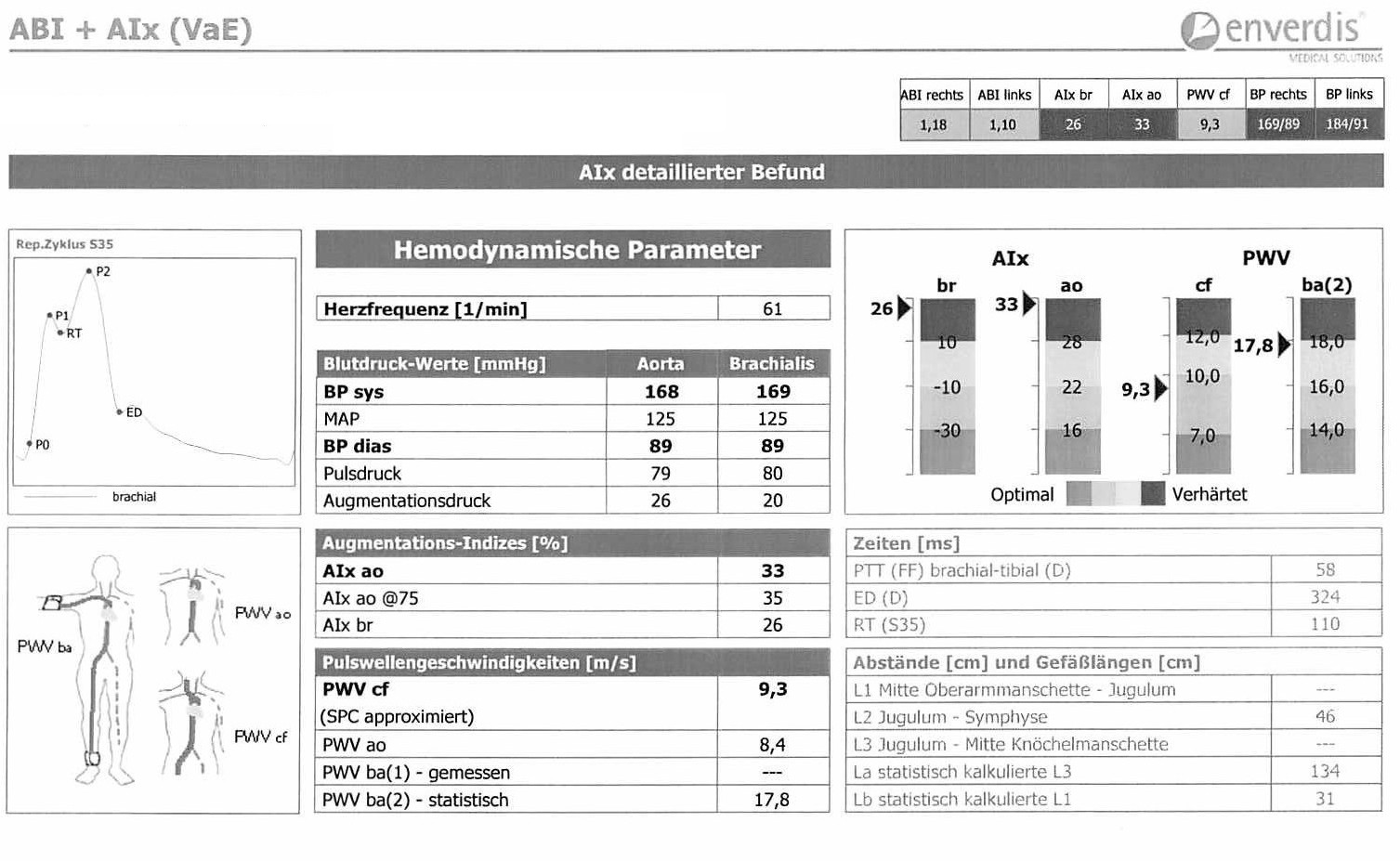 Beispielbefund der Pulswellenanalyse
